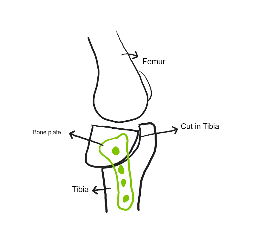 Figure 2 - TPLO Surgery